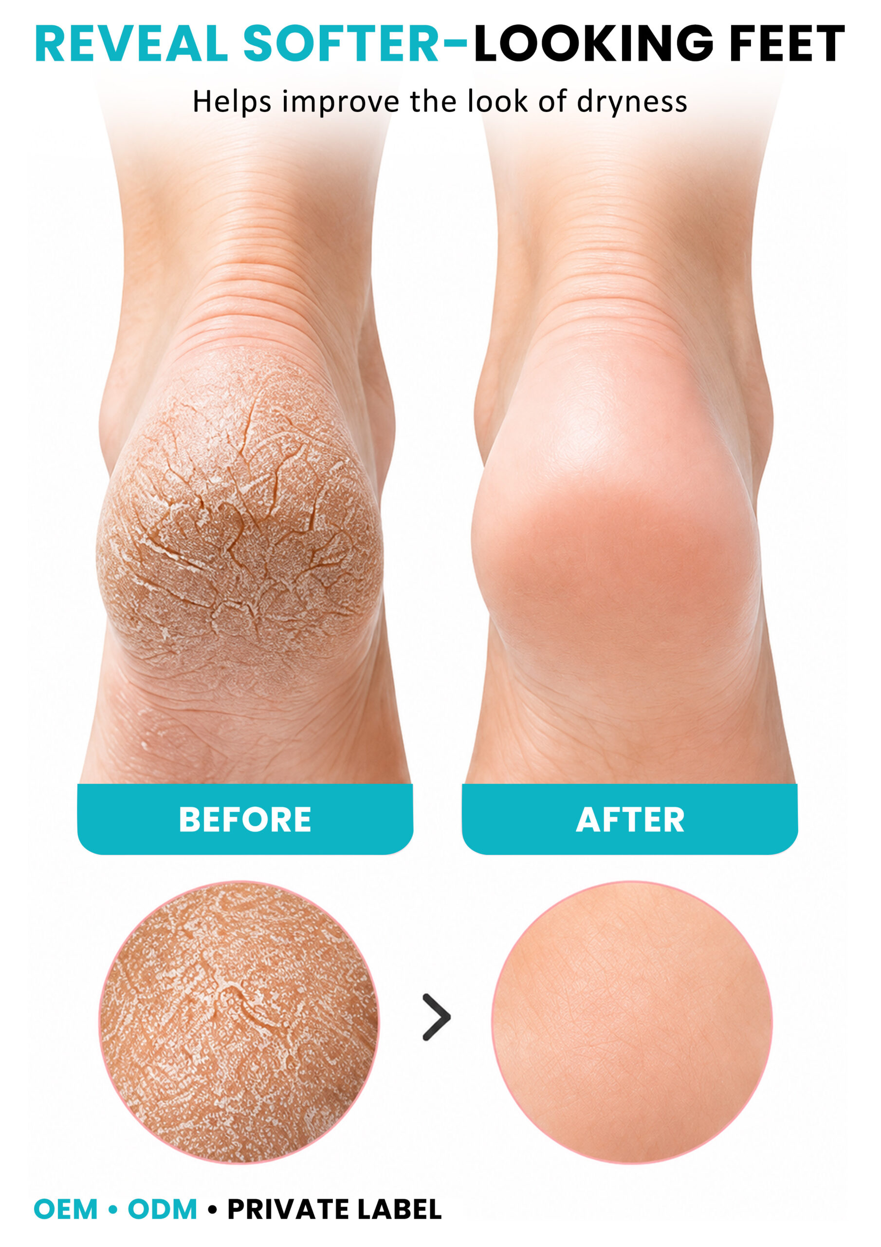 ALLMASK Foot Mask – Before and After ALLMASK foot mask before and after smoother-looking feet