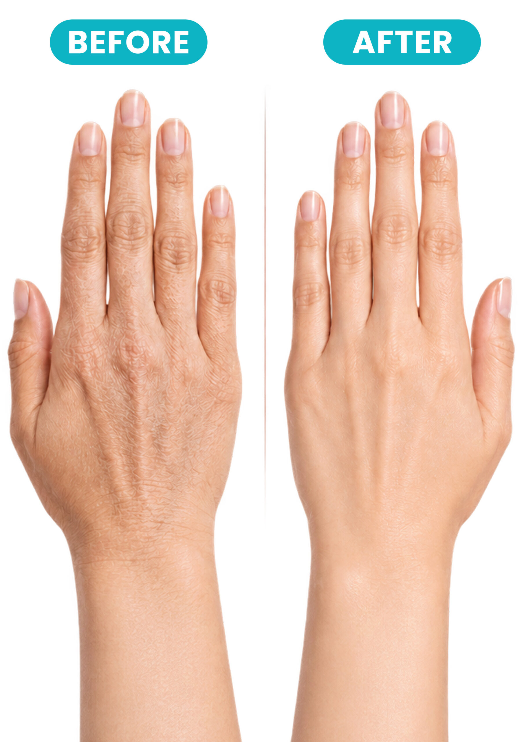 ALLMASK Hand Mask Gloves – Before and After ALLMASK hand mask gloves before and after hand care results