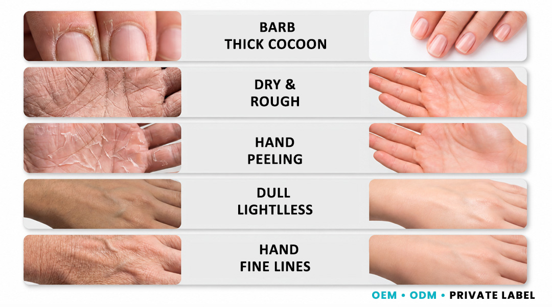 ALLMASK hand mask for dry rough and tired-looking hands